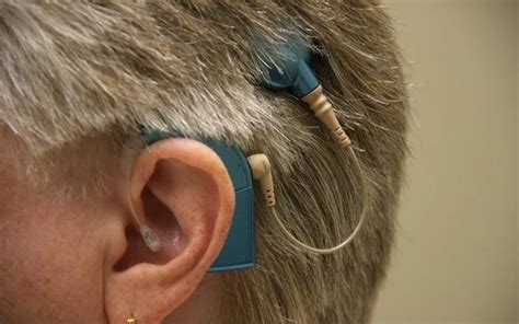 how are hearing aids similar to coclear implants